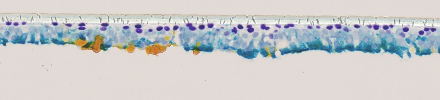 Illustration d’immunomarquage Multiplex IHC.jpg